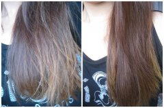 护发不当变秃头 警惕